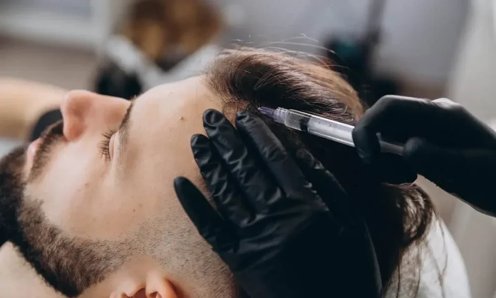 Natural Hair Regrowth with hair restoration in Denville, NJ, at Ascend Regenerative